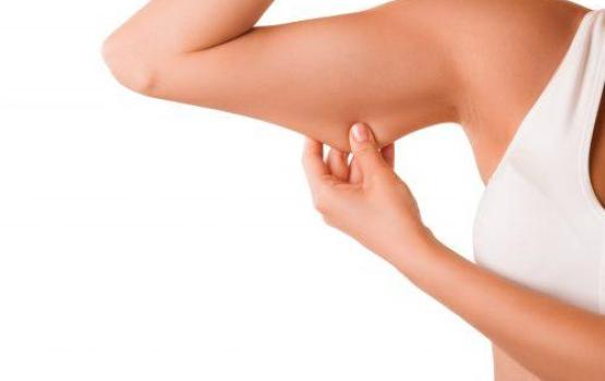 Abdominoplasty & Arm Lift