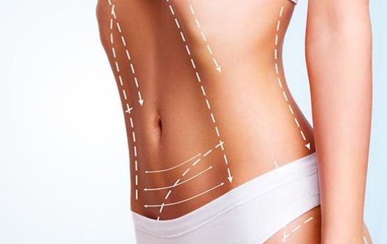 Karın Germe & Tek Bölge Liposuction