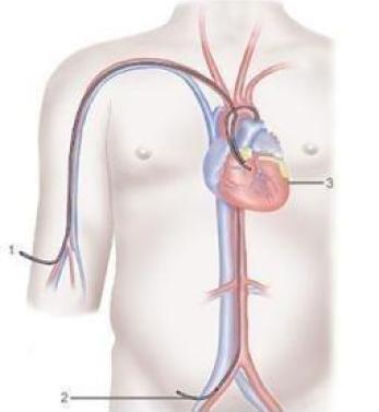 Cardiac Angiography