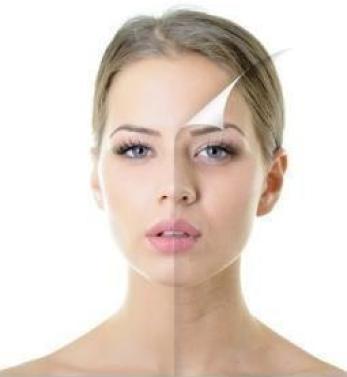 Collagen Face Lift